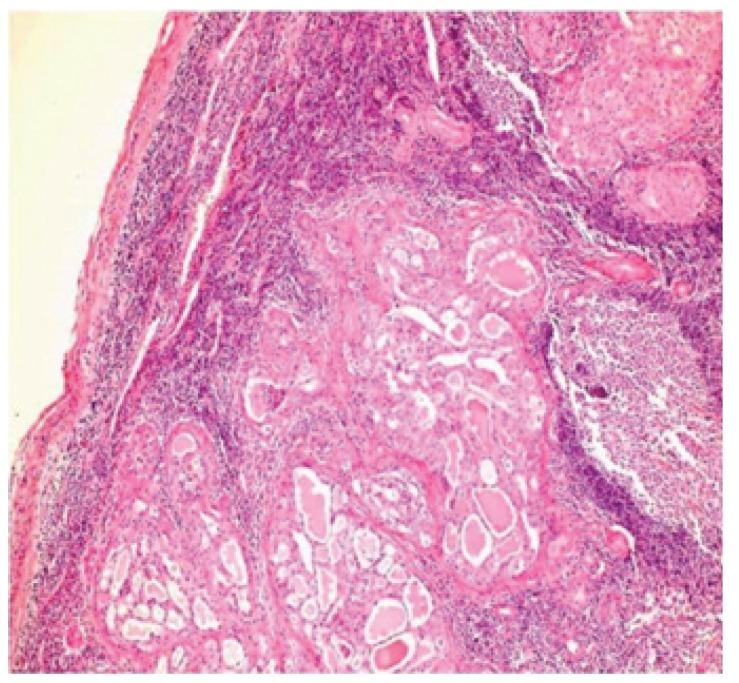 https://cdn.ncbi.nlm.nih.gov/pmc/blobs/3675/4320417/209f448aa89c/medoral-20-e23-g006.jpg