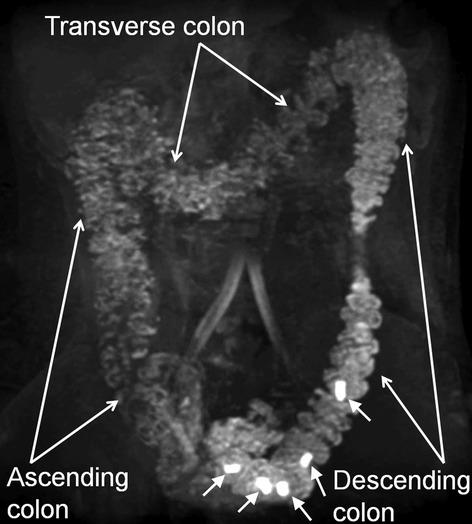 https://cdn.ncbi.nlm.nih.gov/pmc/blobs/367b/4285997/eae22f6e8ef9/nmo0026-0205-f3.jpg