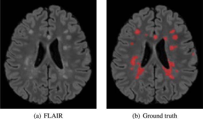 https://cdn.ncbi.nlm.nih.gov/pmc/blobs/3685/12148725/25556be834d0/gr1.jpg