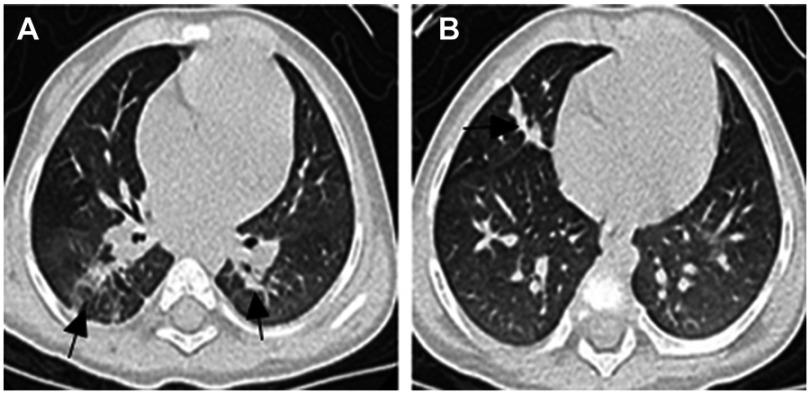 https://cdn.ncbi.nlm.nih.gov/pmc/blobs/3689/6529672/7225beafc890/IDR-12-1277-g0002.jpg
