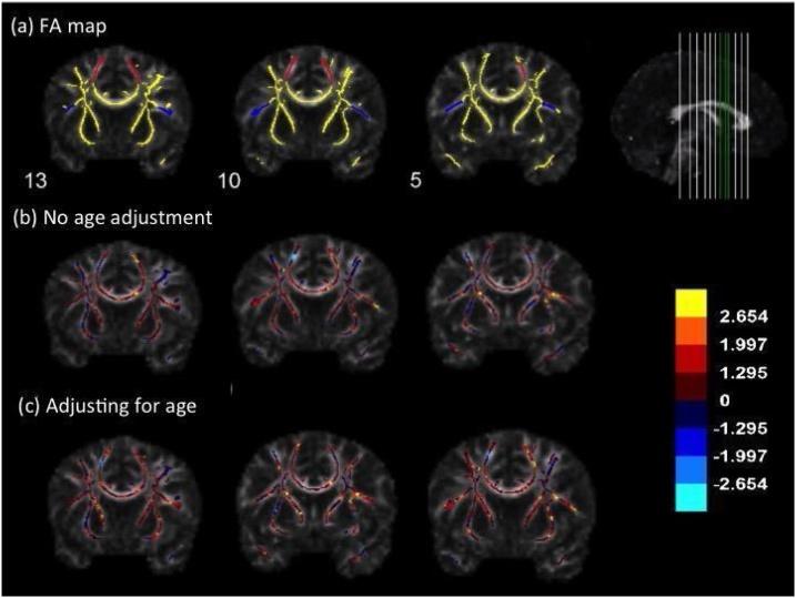 https://cdn.ncbi.nlm.nih.gov/pmc/blobs/368b/8424510/d41a6826f88d/gr1.jpg