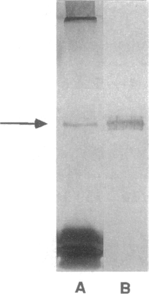 https://cdn.ncbi.nlm.nih.gov/pmc/blobs/3690/196973/db19375ca9d9/jbacter00038-0168-a.jpg