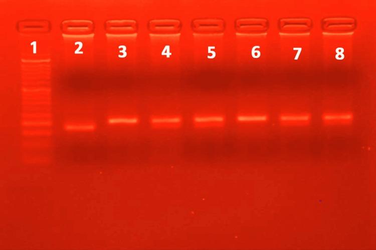 https://cdn.ncbi.nlm.nih.gov/pmc/blobs/369f/11065120/4d26d5f9f395/cureus-0016-00000057465-i06.jpg