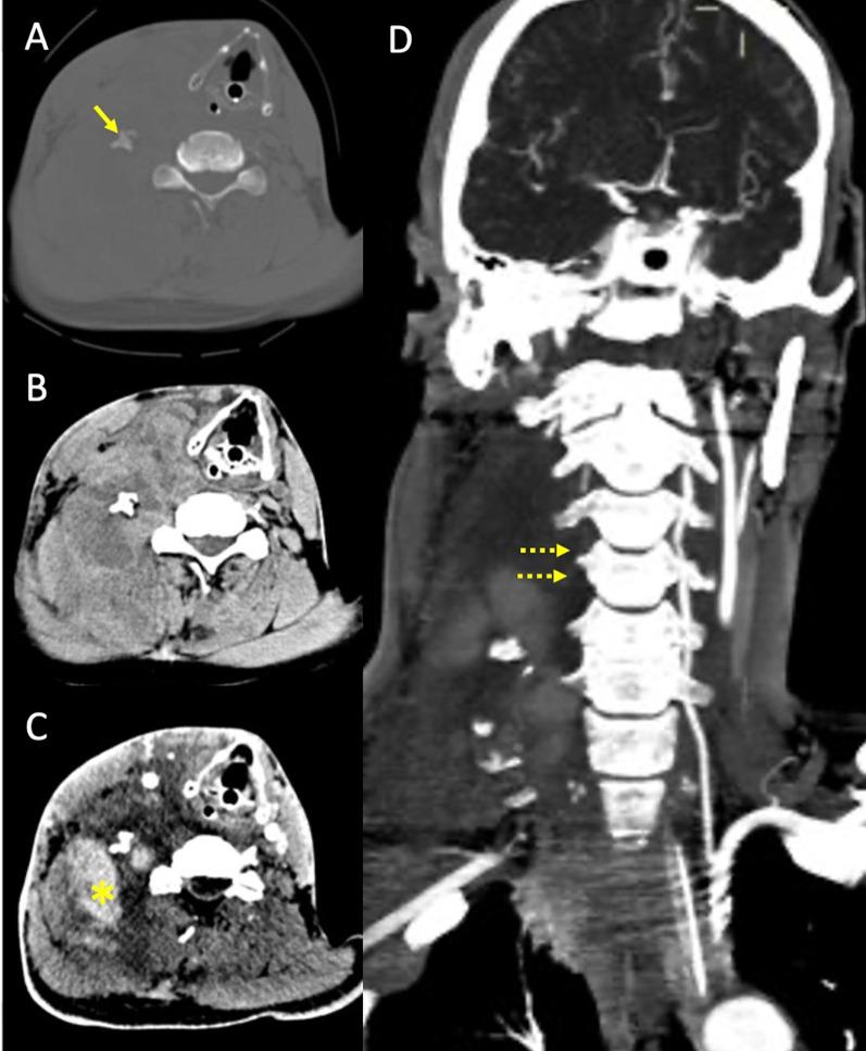 https://cdn.ncbi.nlm.nih.gov/pmc/blobs/369f/12362949/334c576a2dd8/13054_2025_5586_Fig7_HTML.jpg