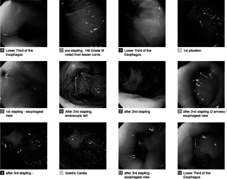 https://cdn.ncbi.nlm.nih.gov/pmc/blobs/36a1/4293474/dd7129fd1cfe/464_2014_3731_Fig2_HTML.jpg