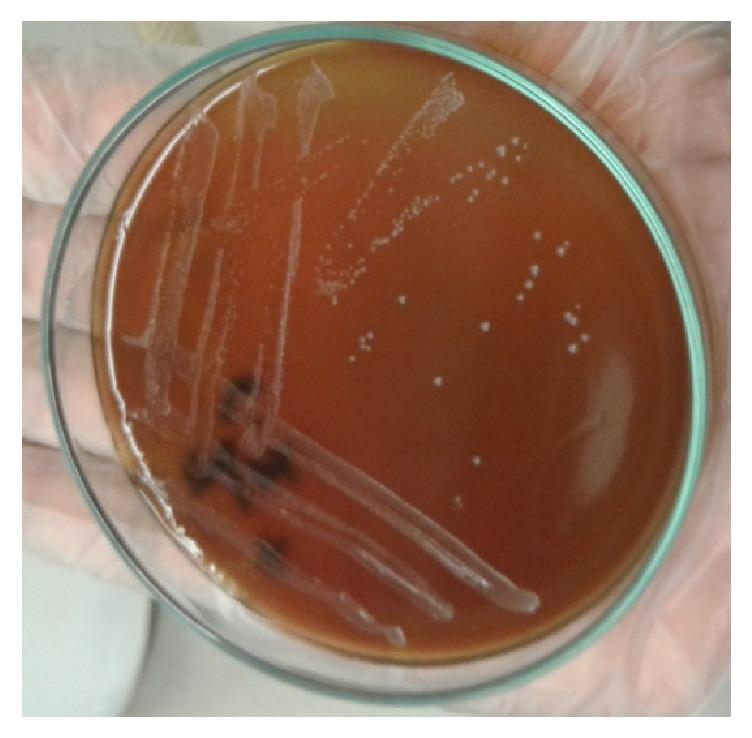 https://cdn.ncbi.nlm.nih.gov/pmc/blobs/36a1/5820567/33e217d5efab/JPATH2018-9378976.003.jpg