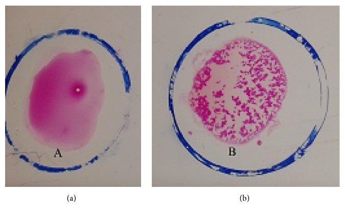https://cdn.ncbi.nlm.nih.gov/pmc/blobs/36a1/5820567/4045b4a0ffbd/JPATH2018-9378976.001.jpg