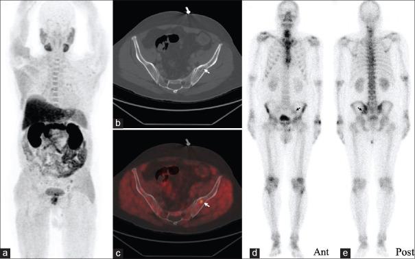 https://cdn.ncbi.nlm.nih.gov/pmc/blobs/36a3/8286002/f87a13bde356/WJNM-20-156-g003.jpg