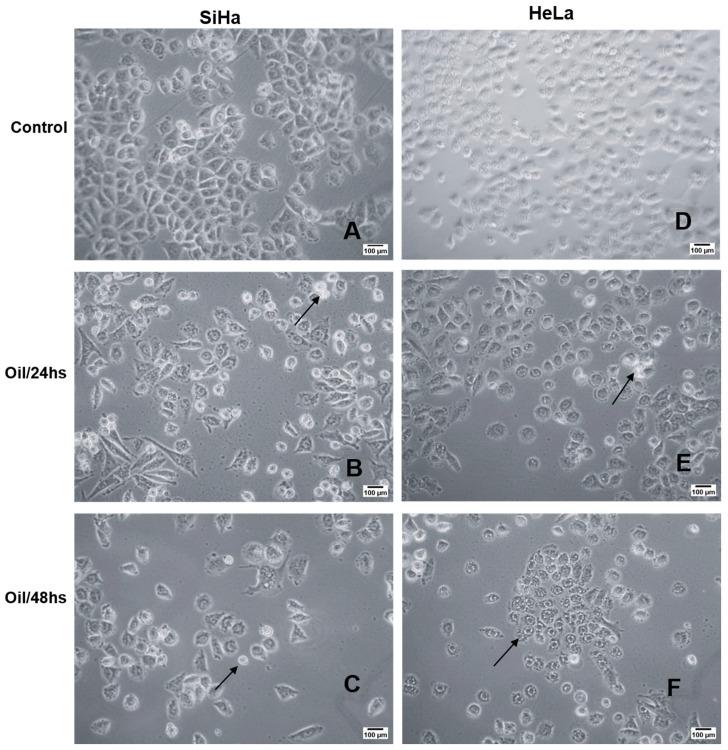 https://cdn.ncbi.nlm.nih.gov/pmc/blobs/36a4/11120212/33d5ad6eb9bb/cimb-46-00235-g008.jpg