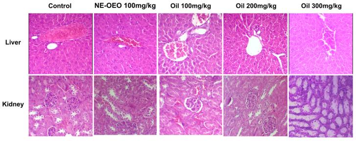 https://cdn.ncbi.nlm.nih.gov/pmc/blobs/36a4/11120212/56df2684b9a2/cimb-46-00235-g015.jpg
