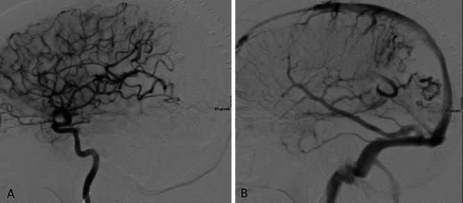 https://cdn.ncbi.nlm.nih.gov/pmc/blobs/36a6/9210269/218a801ba005/CASE21135f3.jpg