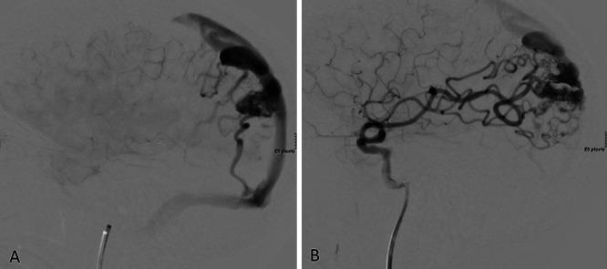 https://cdn.ncbi.nlm.nih.gov/pmc/blobs/36a6/9210269/89c0245a0201/CASE21135f1.jpg