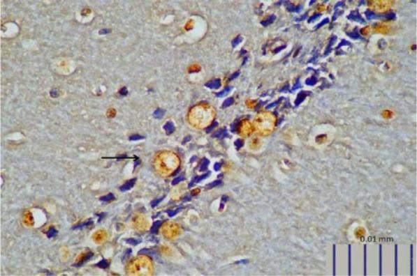 https://cdn.ncbi.nlm.nih.gov/pmc/blobs/36a9/6635314/22ab0c1ebb3c/IJM-11-145-g004.jpg
