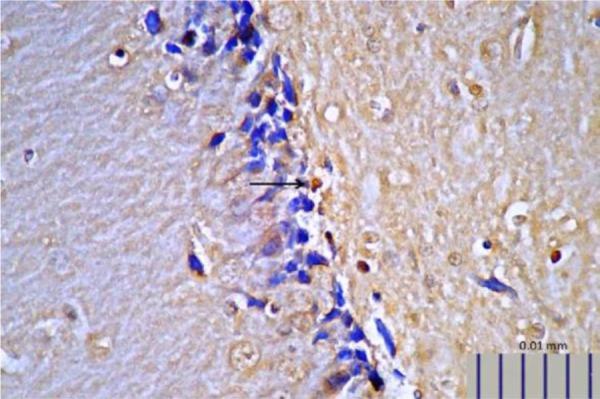 https://cdn.ncbi.nlm.nih.gov/pmc/blobs/36a9/6635314/32bfe8be8e40/IJM-11-145-g010.jpg