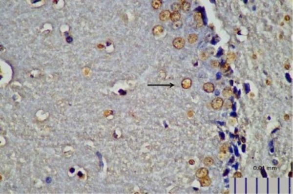 https://cdn.ncbi.nlm.nih.gov/pmc/blobs/36a9/6635314/86b55e707590/IJM-11-145-g008.jpg