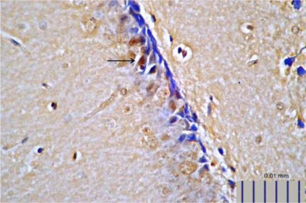 https://cdn.ncbi.nlm.nih.gov/pmc/blobs/36a9/6635314/bcf5d54ca139/IJM-11-145-g011.jpg