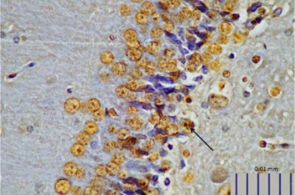 https://cdn.ncbi.nlm.nih.gov/pmc/blobs/36a9/6635314/e17e9cb6f5d4/IJM-11-145-g005.jpg