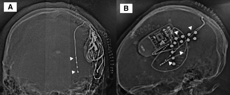 https://cdn.ncbi.nlm.nih.gov/pmc/blobs/36ab/7812309/48b90a151acb/nmc-61-1-g4.jpg