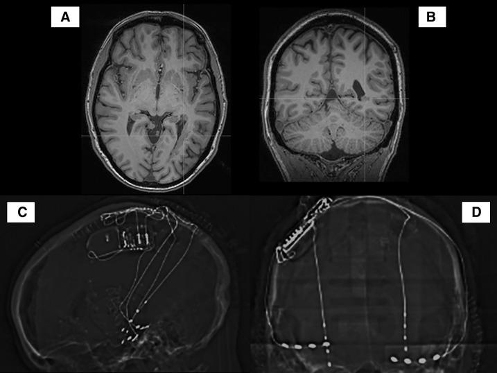 https://cdn.ncbi.nlm.nih.gov/pmc/blobs/36ab/7812309/70e2e3166114/nmc-61-1-g5.jpg