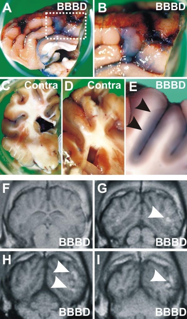 https://cdn.ncbi.nlm.nih.gov/pmc/blobs/36ae/2842276/0352e3077bfd/1471-2202-11-34-3.jpg
