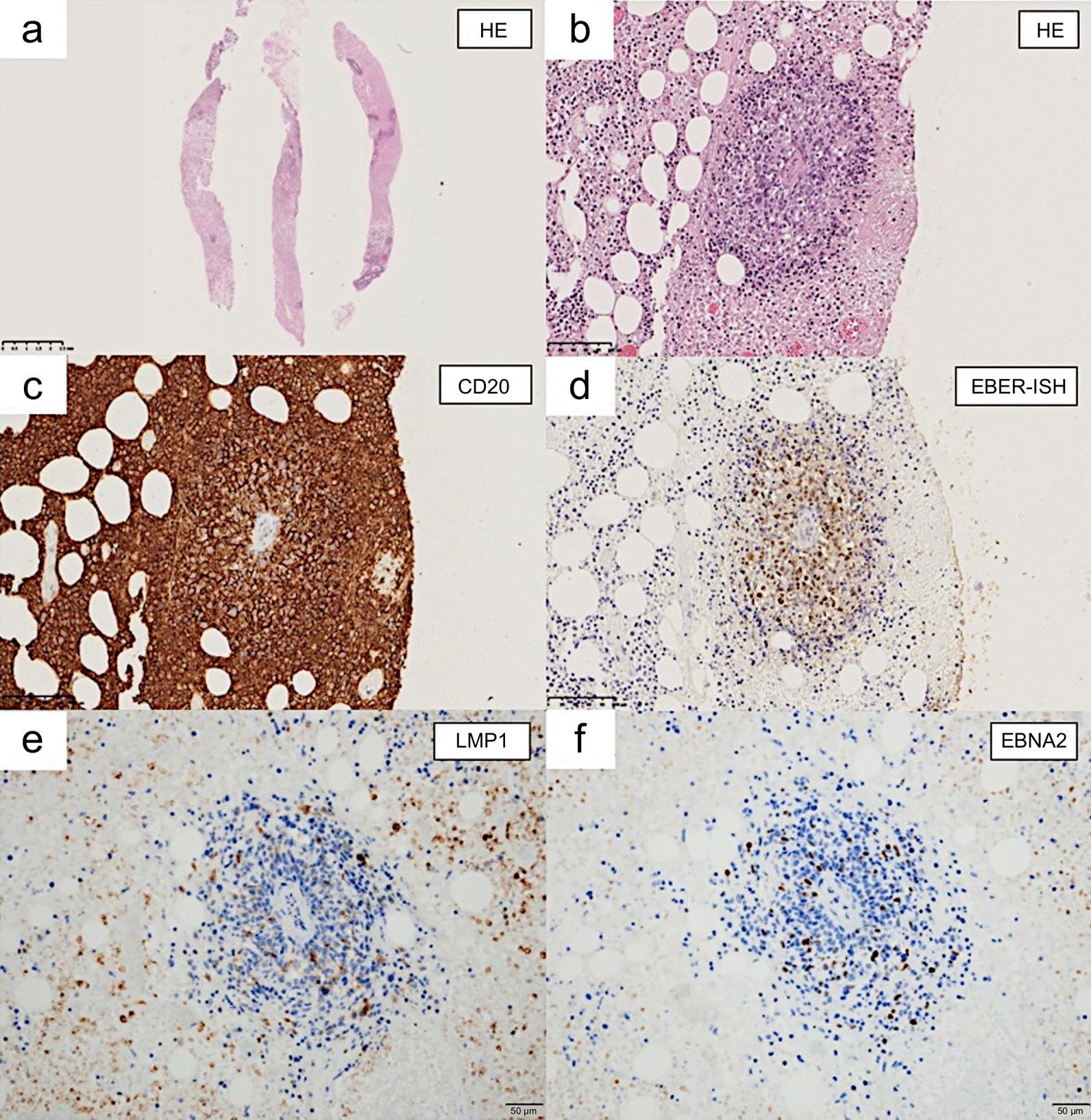 https://cdn.ncbi.nlm.nih.gov/pmc/blobs/36ae/8819973/3c400cee79a0/13256_2022_3274_Fig5_HTML.jpg
