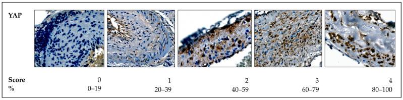https://cdn.ncbi.nlm.nih.gov/pmc/blobs/36b4/12028238/1ae832b328fb/ijms-26-03791-g006.jpg