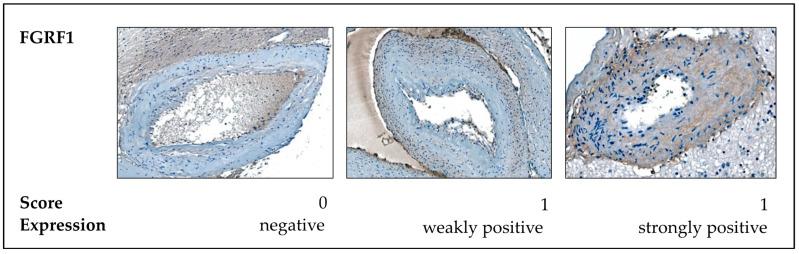 https://cdn.ncbi.nlm.nih.gov/pmc/blobs/36b4/12028238/36d8e33b3edb/ijms-26-03791-g007.jpg
