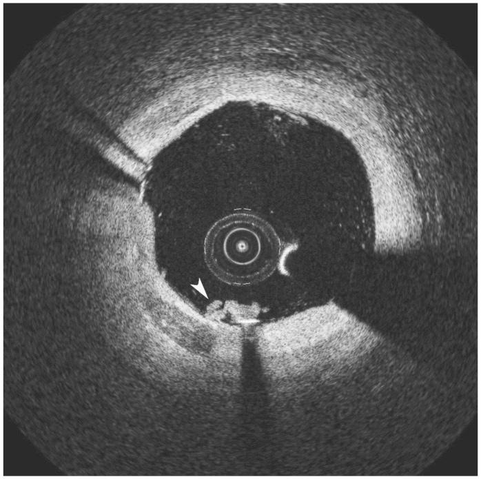 https://cdn.ncbi.nlm.nih.gov/pmc/blobs/36b4/3569566/23c3785b02e6/kcj-43-44-g004.jpg