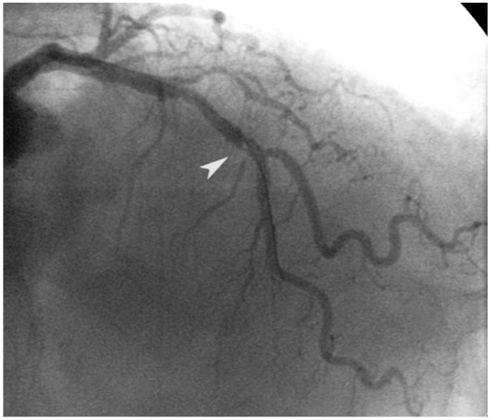 https://cdn.ncbi.nlm.nih.gov/pmc/blobs/36b4/3569566/d7590faa39ef/kcj-43-44-g002.jpg