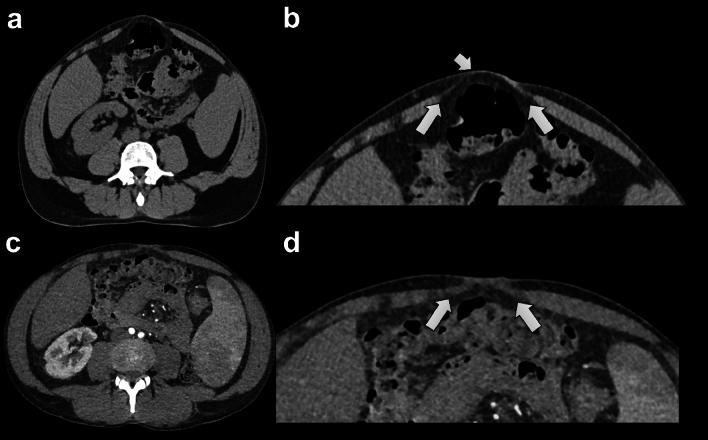 https://cdn.ncbi.nlm.nih.gov/pmc/blobs/36c3/11449955/cc81982ebfb4/10029_2024_3036_Fig4_HTML.jpg