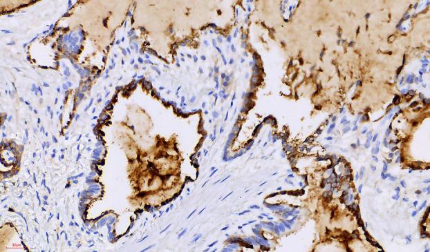 https://cdn.ncbi.nlm.nih.gov/pmc/blobs/36c9/11444930/851879ed07db/TCA-15-1975-g002.jpg