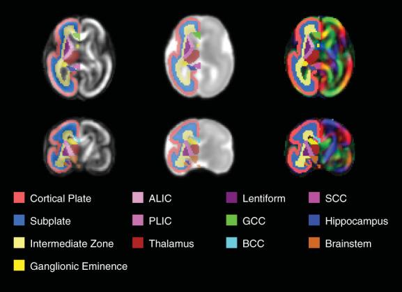 https://cdn.ncbi.nlm.nih.gov/pmc/blobs/36cc/9921217/cbeef40980d3/HBM-44-1593-g004.jpg