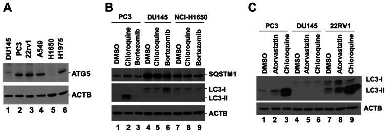 https://cdn.ncbi.nlm.nih.gov/pmc/blobs/36cd/8298997/f2a4d660f0dc/ol-22-03-12899-g00.jpg