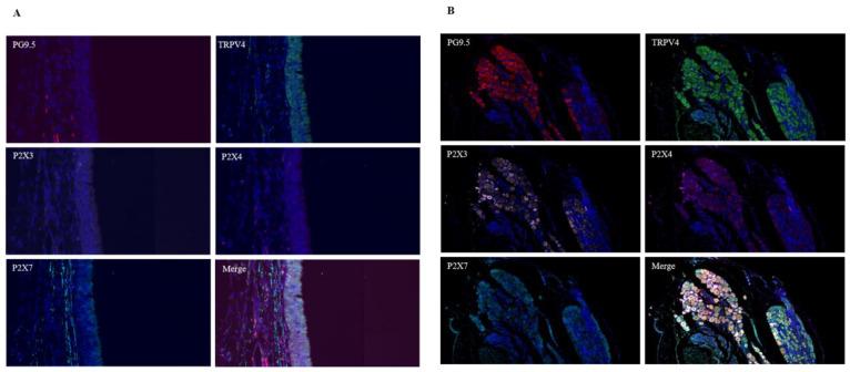 https://cdn.ncbi.nlm.nih.gov/pmc/blobs/36cf/11852612/dff8f8e0f9ca/biomolecules-15-00285-g002.jpg