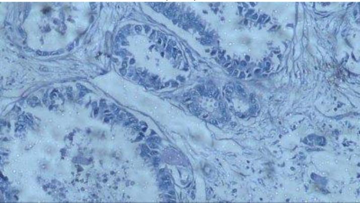 https://cdn.ncbi.nlm.nih.gov/pmc/blobs/36cf/6141431/94fb7278355a/IJHOSCR-12-103-g002.jpg