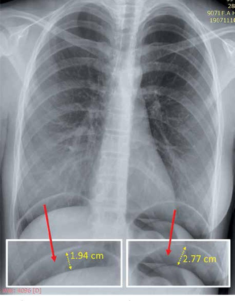 https://cdn.ncbi.nlm.nih.gov/pmc/blobs/36d4/7457197/a8c96850db4f/WIITM-15-38625-g002.jpg
