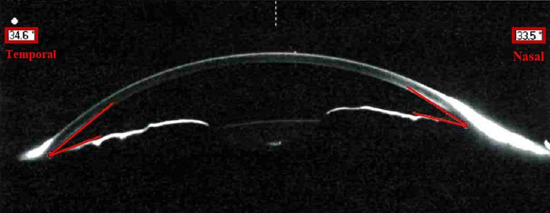 https://cdn.ncbi.nlm.nih.gov/pmc/blobs/36d5/11324241/2f79c60e2515/cop-2024-0015-0001-540080_F03.jpg