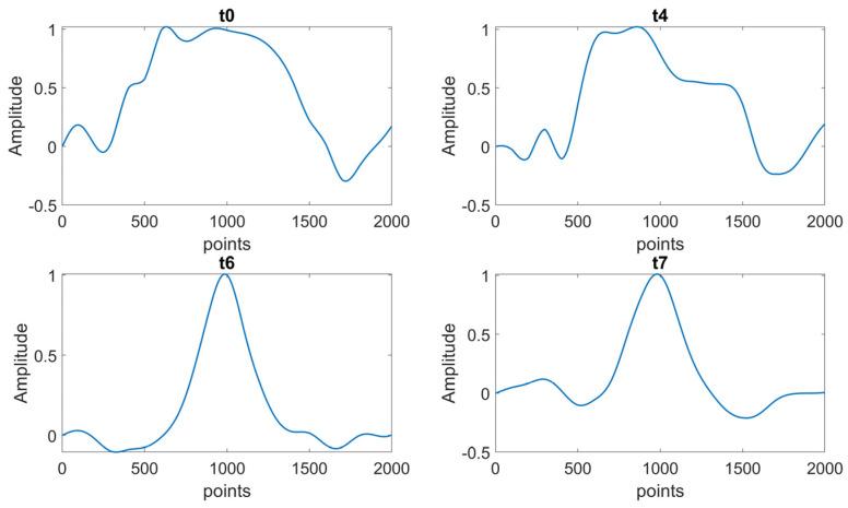 https://cdn.ncbi.nlm.nih.gov/pmc/blobs/36dc/10674468/ac726d7179ba/sensors-23-09292-g014.jpg