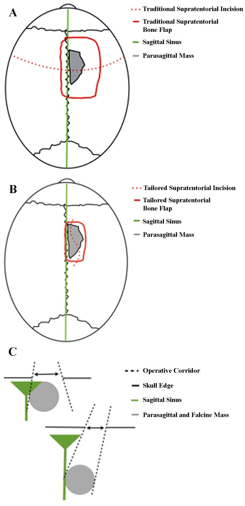 https://cdn.ncbi.nlm.nih.gov/pmc/blobs/36e1/4889455/3e19ae35bc1d/cureus-0008-000000000588-i05.jpg