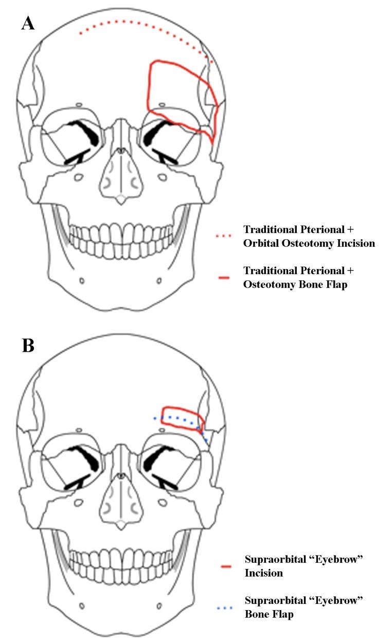 https://cdn.ncbi.nlm.nih.gov/pmc/blobs/36e1/4889455/c829a9d8354b/cureus-0008-000000000588-i02.jpg