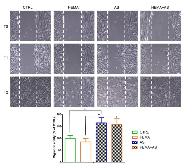 https://cdn.ncbi.nlm.nih.gov/pmc/blobs/36e4/6981406/144f1f68c63a/materials-13-00130-g003.jpg