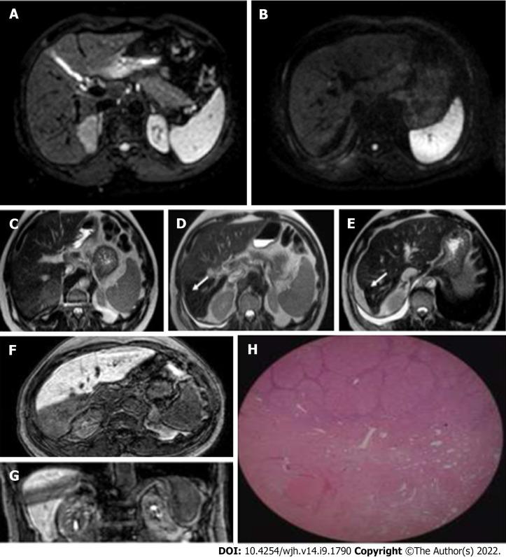 https://cdn.ncbi.nlm.nih.gov/pmc/blobs/36ea/9521449/5c38b787fb3f/WJH-14-1790-g013.jpg