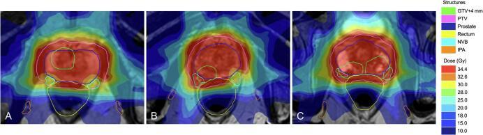 https://cdn.ncbi.nlm.nih.gov/pmc/blobs/36eb/8473534/42f6f2a68c92/gr2.jpg