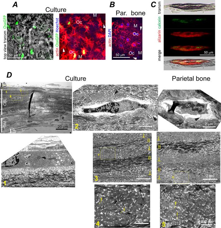 https://cdn.ncbi.nlm.nih.gov/pmc/blobs/36ec/9850442/5a8b8508dc49/JBM4-7-e10701-g003.jpg