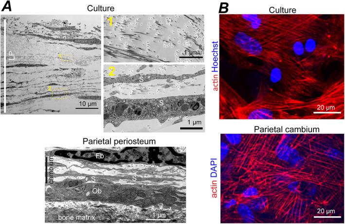 https://cdn.ncbi.nlm.nih.gov/pmc/blobs/36ec/9850442/bd6c7303bc54/JBM4-7-e10701-g009.jpg