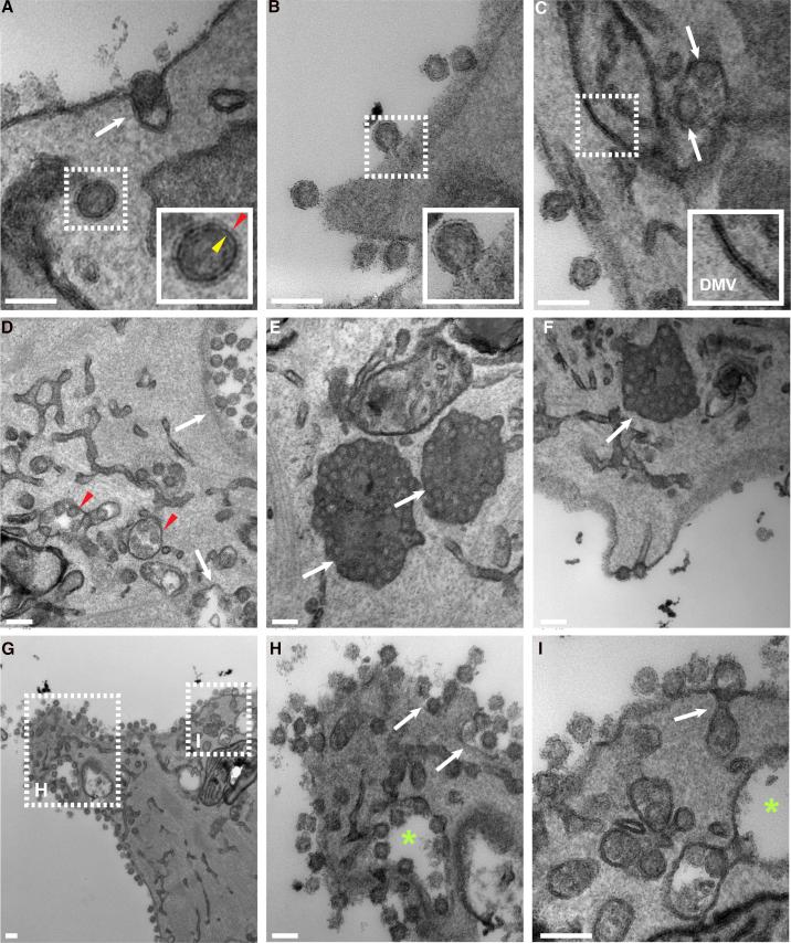 https://cdn.ncbi.nlm.nih.gov/pmc/blobs/36ee/7940443/21646cd4b9af/gr3.jpg
