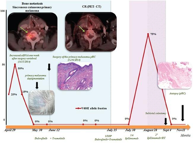https://cdn.ncbi.nlm.nih.gov/pmc/blobs/36f5/5302939/f54ba6b87570/oncotarget-07-56619-g001.jpg