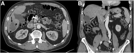https://cdn.ncbi.nlm.nih.gov/pmc/blobs/36f9/5514460/844fcfe53857/40425_2017_263_Fig2_HTML.jpg