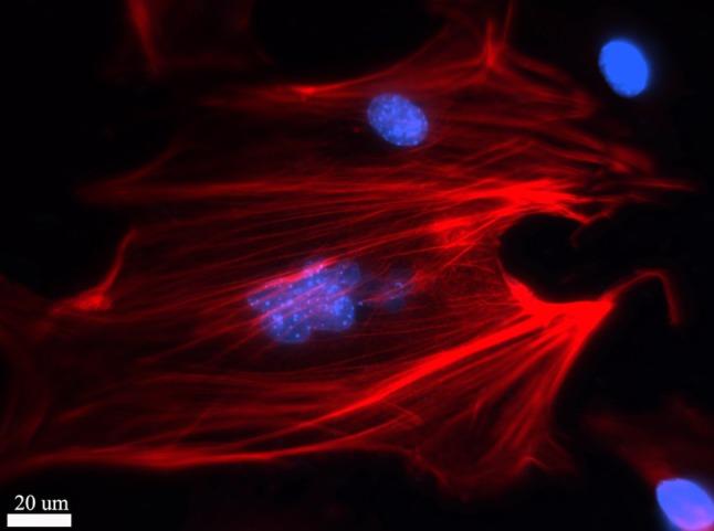 https://cdn.ncbi.nlm.nih.gov/pmc/blobs/36fa/3445794/8774855c897c/383_2012_3162_Fig4_HTML.jpg