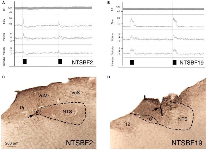 https://cdn.ncbi.nlm.nih.gov/pmc/blobs/36fb/5053990/24ecb22d1138/fnana-10-00094-g0003.jpg